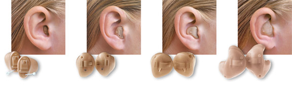 Custom (In-the-Ear) hearing instruments